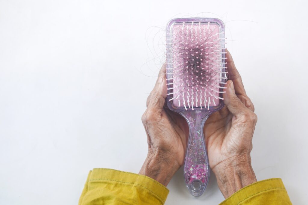hair loss on keto